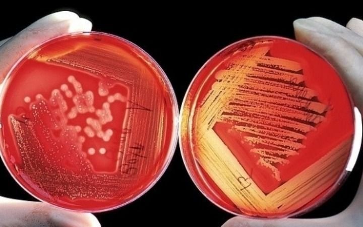 Cómo proteger a los chicos del estreptococo, la bacteria que ya se cobró seis vidas