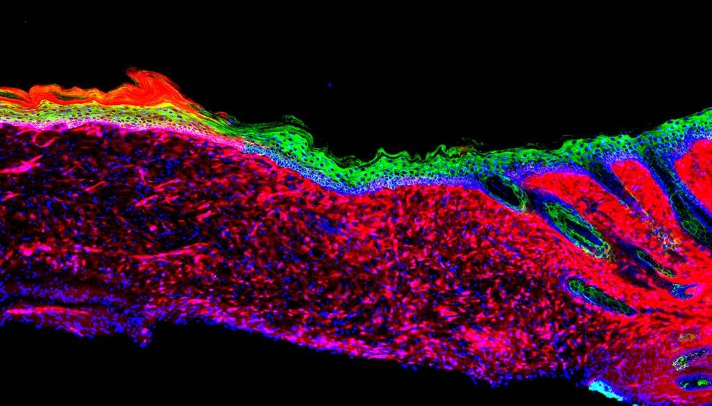 Los científicos logran por primera vez regenerar “in vivo” la piel de un mamífero