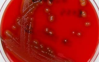 Dos pequeños murieron por estreptococo y ahora ascienden a 8 las víctimas