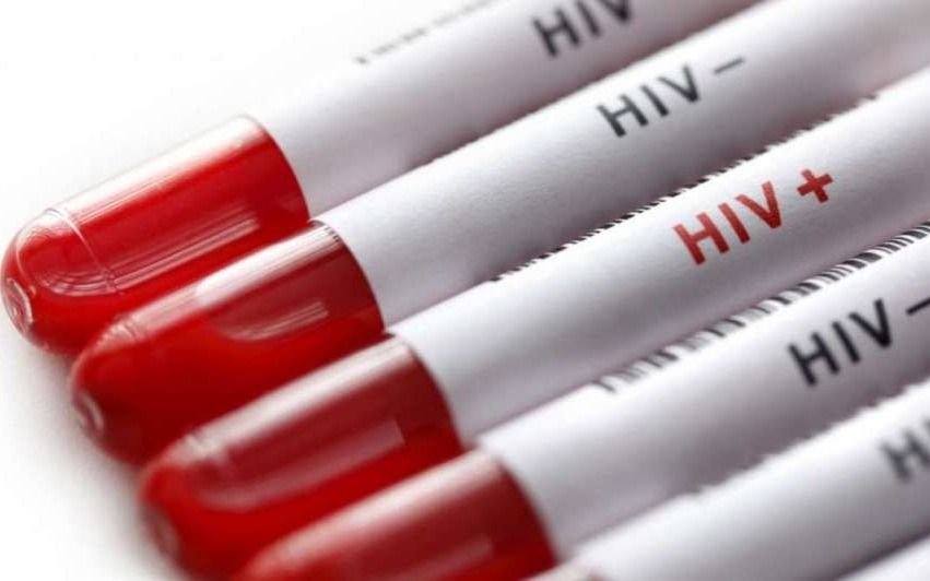 Logran un remedio que puede frenar al virus del sida durante al menos 4 meses