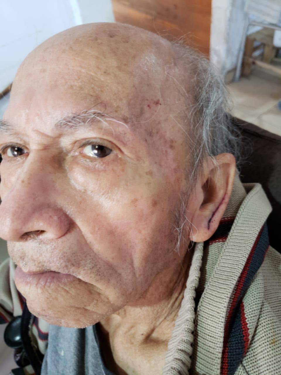 Denunciaron a un cuidador por golpear a un hombre de 72 años