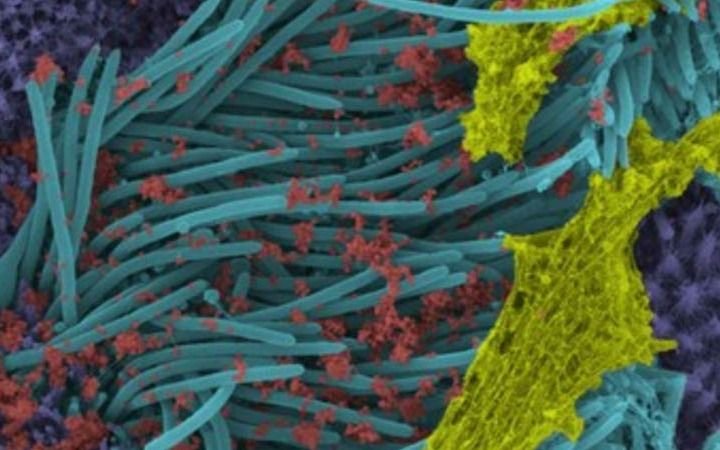 Revelan impactantes imágenes de células infectadas con Covid