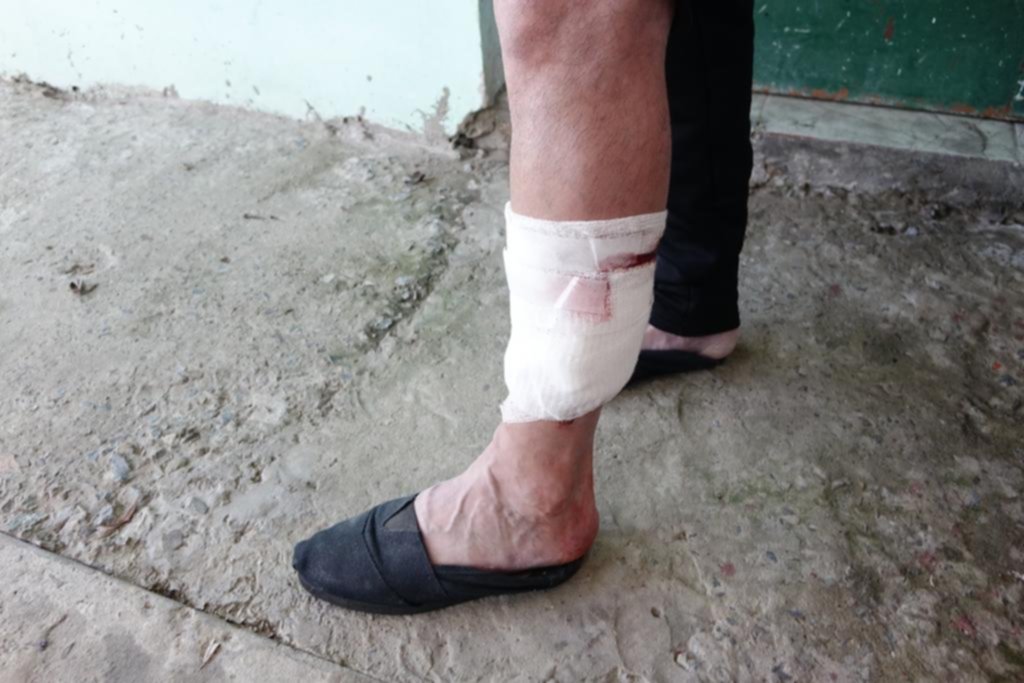 Frustró a trompadas un asalto, pero el ladrón le pegó un balazo