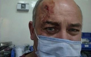Vecino platense fue baleado en Tolosa en un confuso episodio