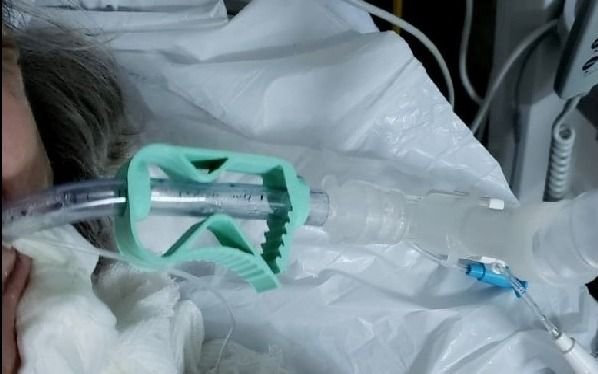 Hospitales de La Plata ya usan el novedoso dispositivo para respiradores artificiales creado por la Facultad de Artes