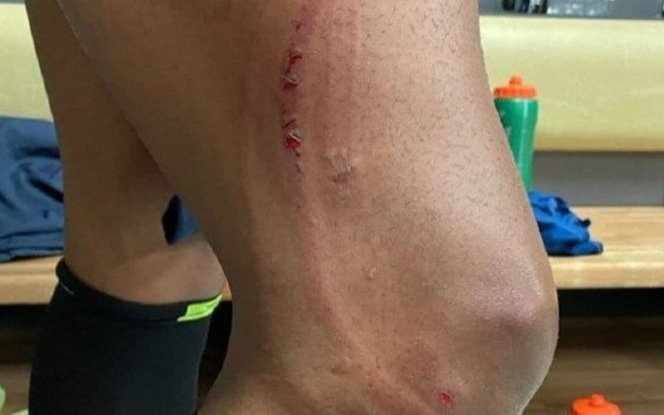 Ocurrió en Eliminatorias: le quedó la pierna a la miseria pero el VAR no vio penal