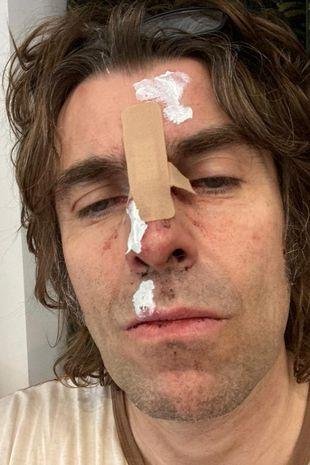 Cara rota: Liam Gallagher se cayó de un helicóptero a “100 mil pies”, pero está bien