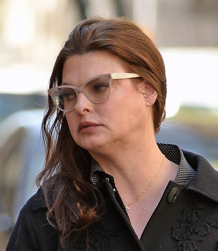 Linda Evangelista, desfigurada tras un tratamiento estético