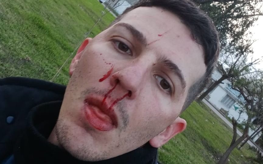 Ensenada: otro hecho violento con 10 heridos por la interna de la UOCRA