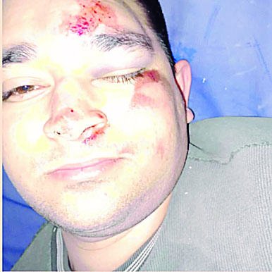 Golpean durante un asalto a un joven que fue a comprar a la carnicería