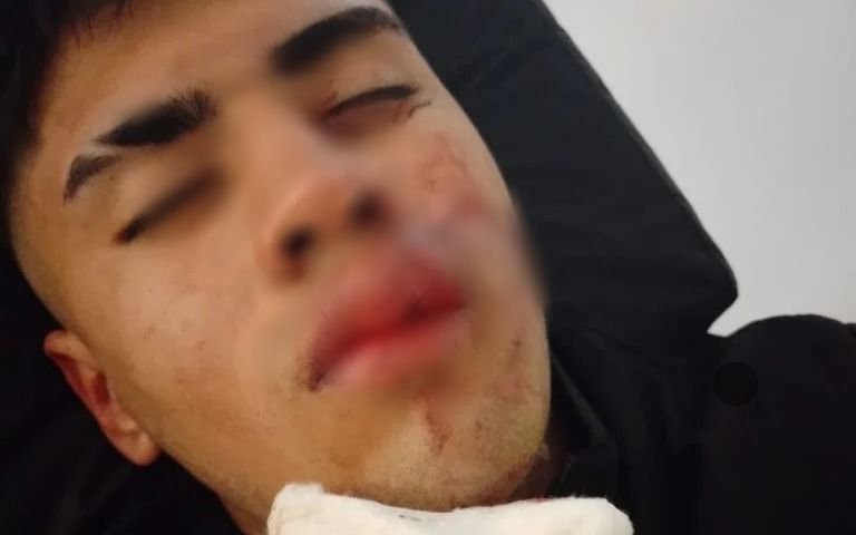Dos jóvenes recibieron una fuerte golpiza en Mar del Plata y uno de ellos debió ser internado