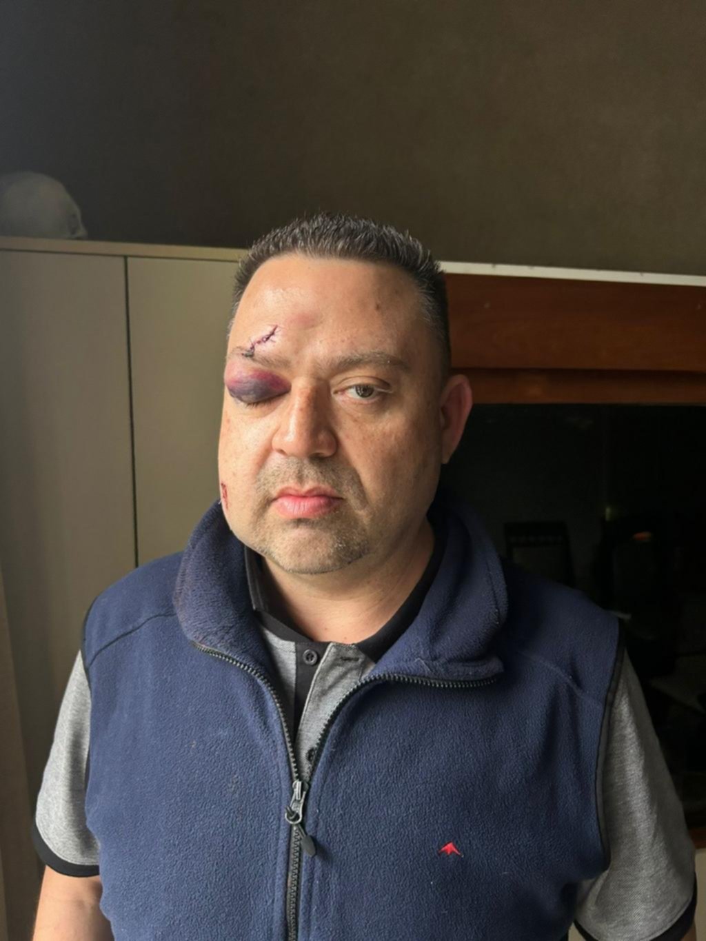Un hombre denunció un salvaje ataque en 19 y 53