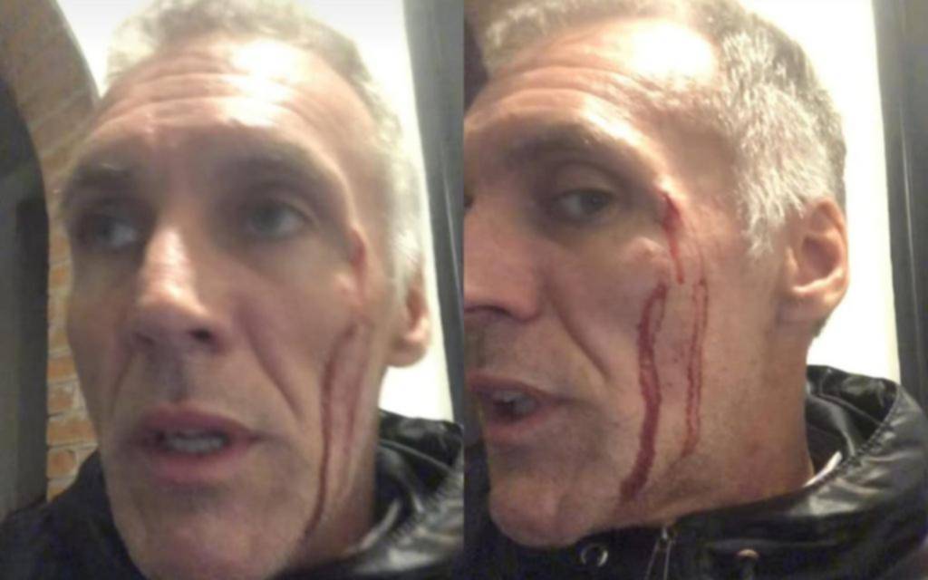 Encañonan y golpean a un exconcejal de La Plata