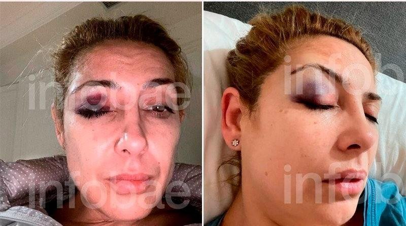 Declaró la madre de Yáñez: “Vi cómo Alberto empujaba a mi hija”