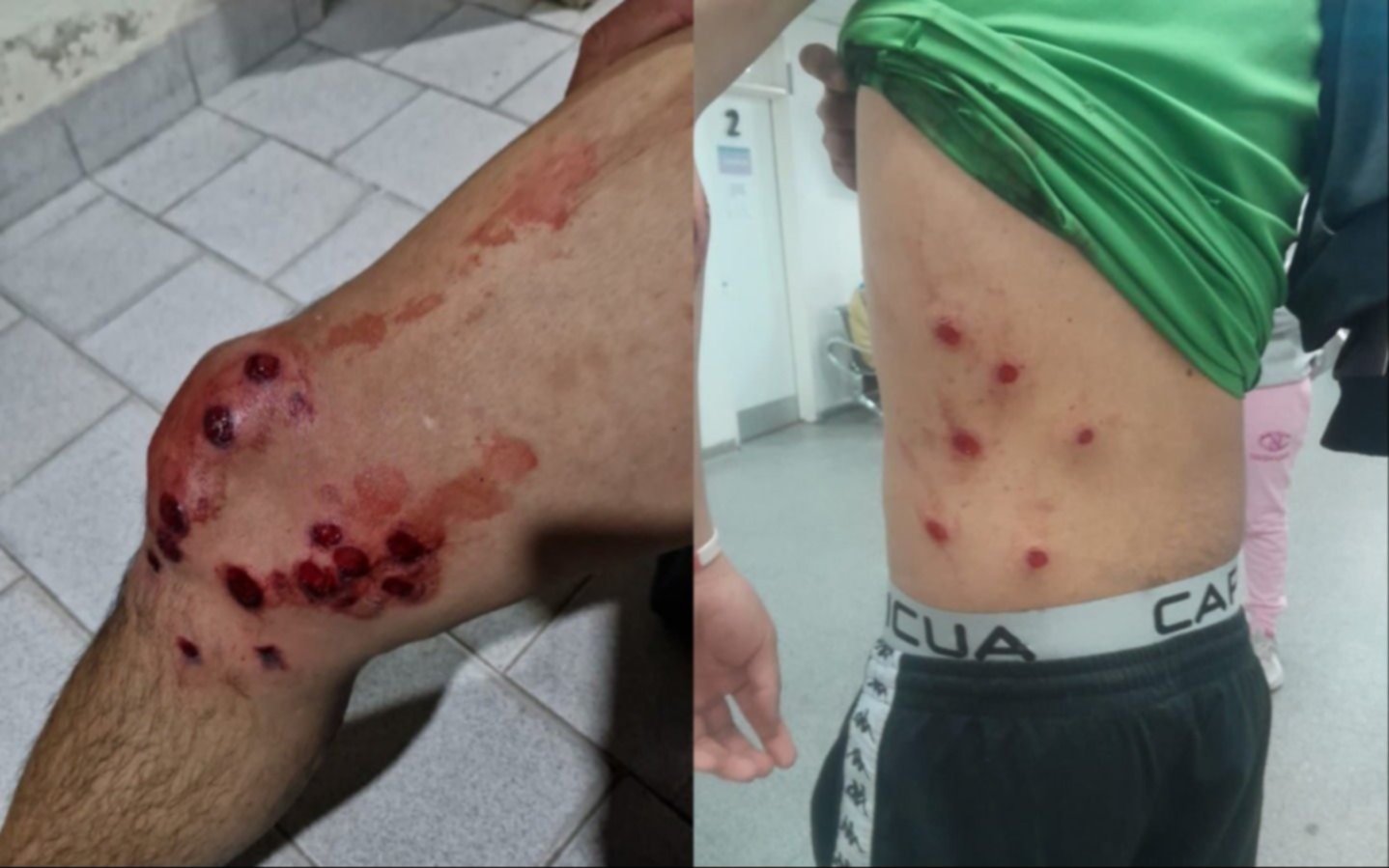 Violencia en el fútbol: se suspendieron todos los torneos de la Liga Amateur Platense