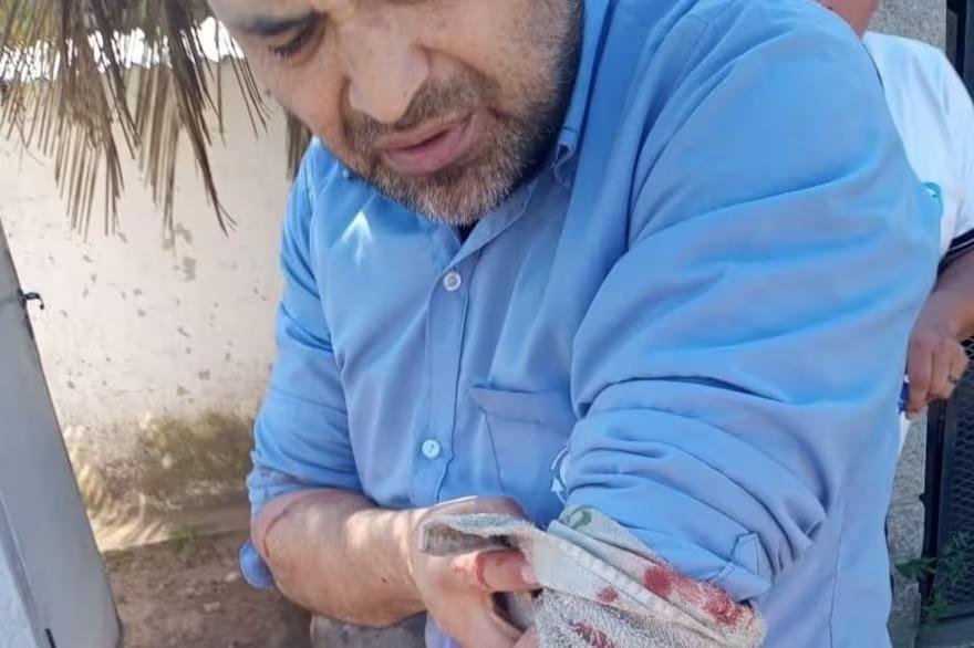 Otro colectivero atacado en medio de un asalto