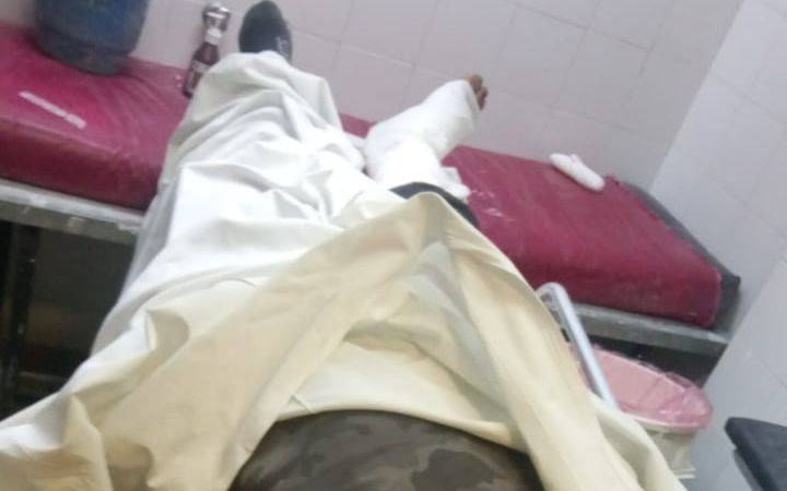 El ladrón de La Plata que intentó huir de la policía saltando paredones y sufrió una fractura expuesta de tobillo