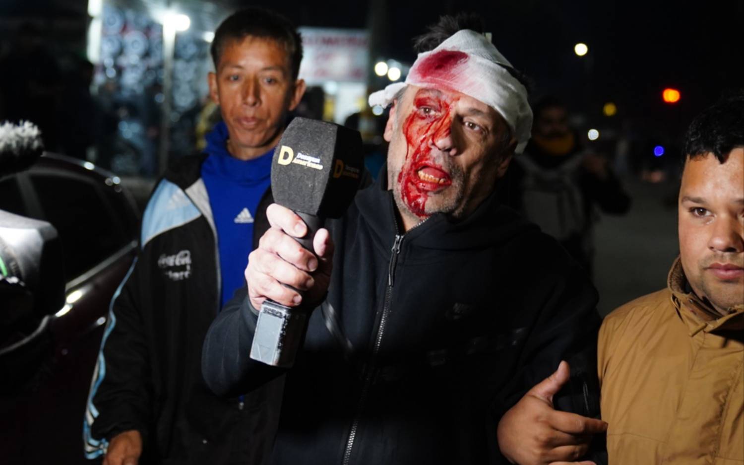 Le "rompieron" la cabeza a un periodista de América TV en el acto de Milei