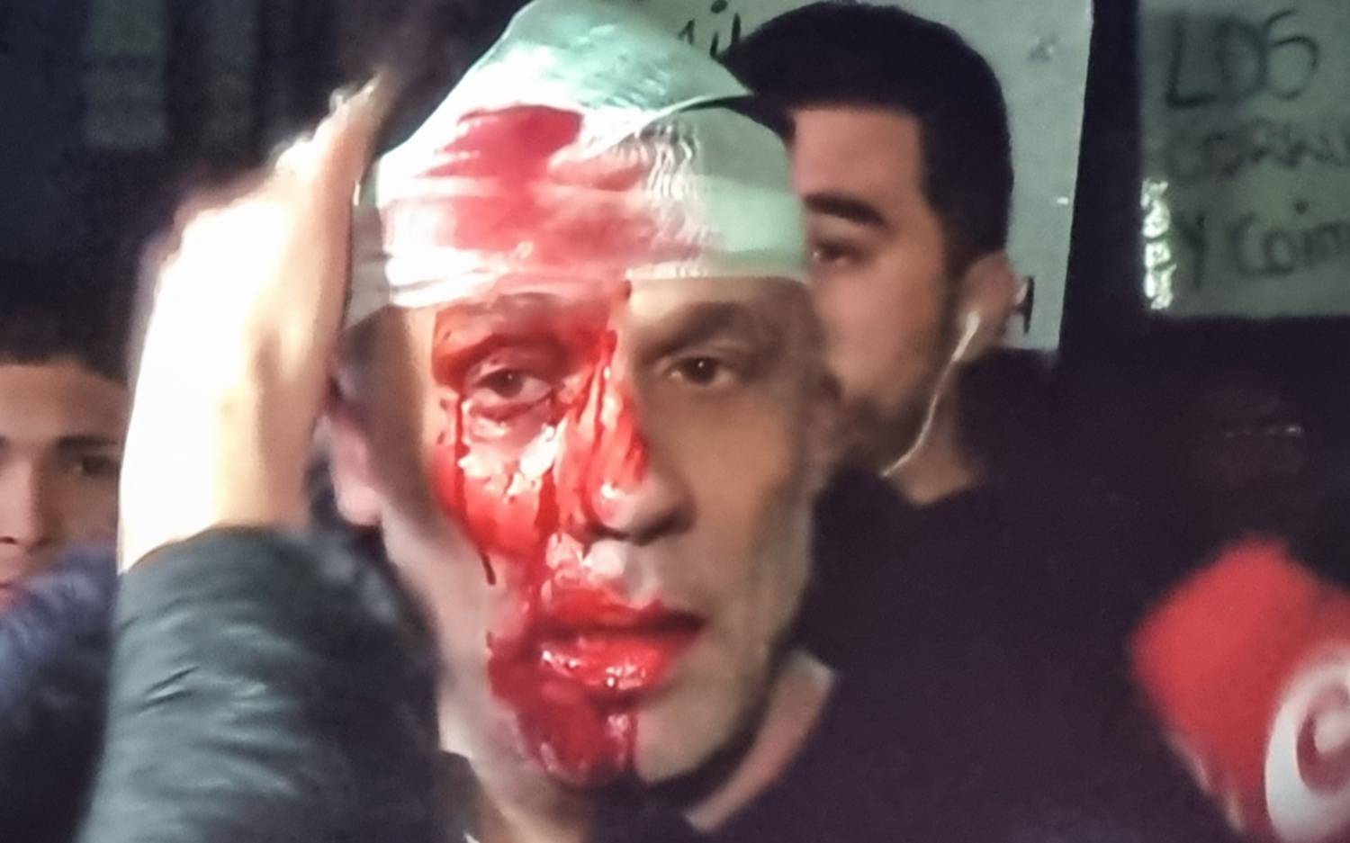 Quién es Cristian Mercante, el periodista herido durante el acto de Javier Milei en Moreno