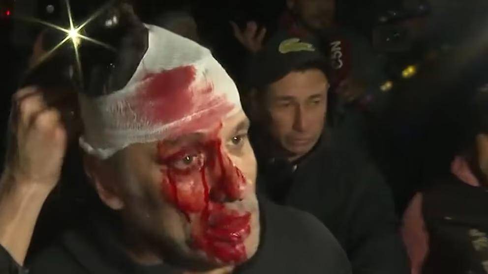 Insultos, choques, corridas y un notero herido