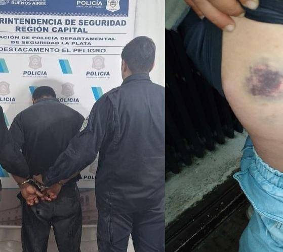 Violencia extrema en La Plata: intentó matar a su pareja y terminó preso