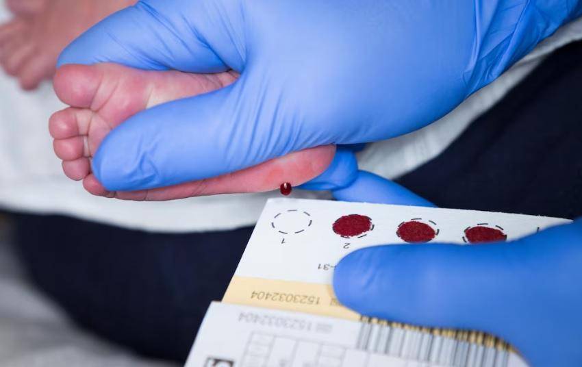 Avanza la inclusión de la atrofia muscular en la pesquisa neonatal