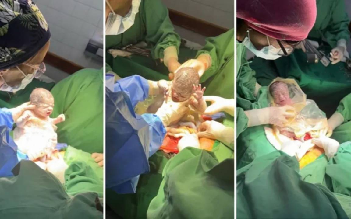 Nacieron trigemelas en Salta: un caso que sucede cada un millón
