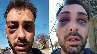 Un luthier de La Plata fue desfigurado en un operativo policial en La Pampa