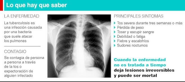 Tuberculosis: implementan nueva terapia en la Región