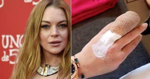 Lindsay Lohan casi pierde el dedo en un accidente