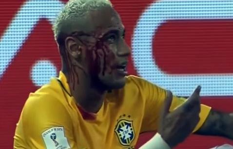 Neymar, bañado en sangre luego de un codazo