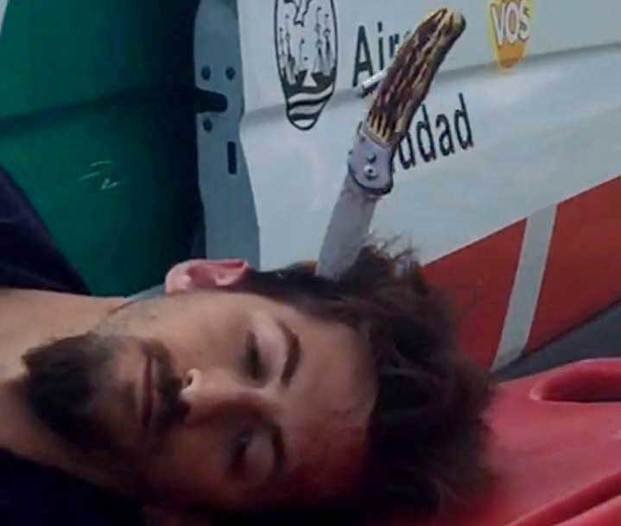 Apuñaló a dos chicas: le clavaron el cuchillo en la cabeza