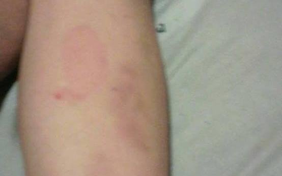 Denuncian que alumnos de la escuela 55 golpearon a un compañerito con TDAH