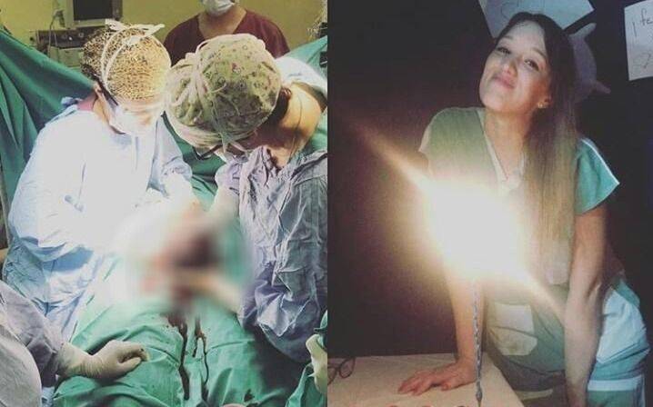 Sacaron selfies mientras realizaban una cesárea 
