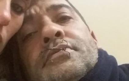 Preso por violencia de género se cosió la boca