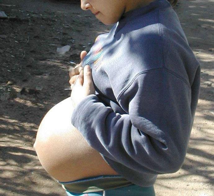 Embarazo adolescente, el conflicto de la maternidad temprana
