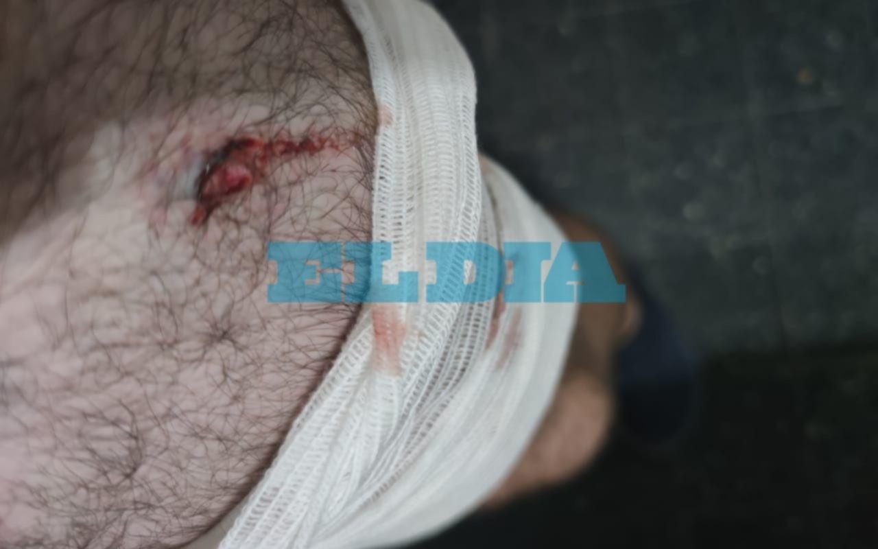 Atacaron a cuchillazos a un delivery y le robaron la moto en 22, entre 69 y 70