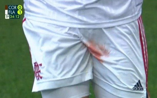 ¡Que dolor!: le pisaron los testículos en el medio del partido y salió con el pantalón ensangrentado