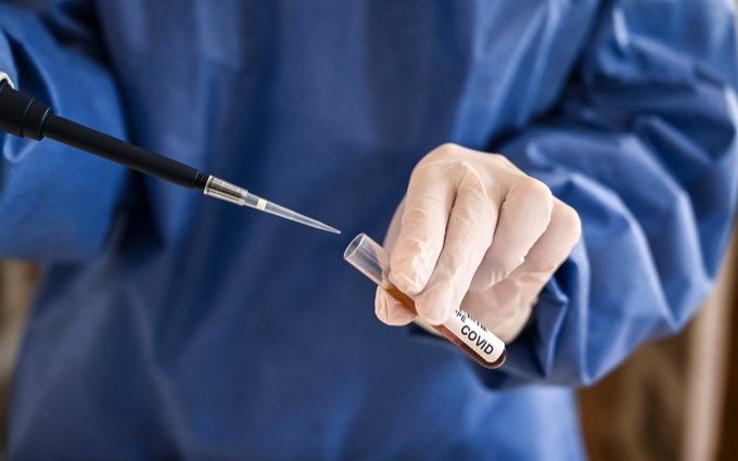Brasil seguirá con pruebas de Vacuna de Oxford tras la muerte del voluntario "que recibió un placebo"