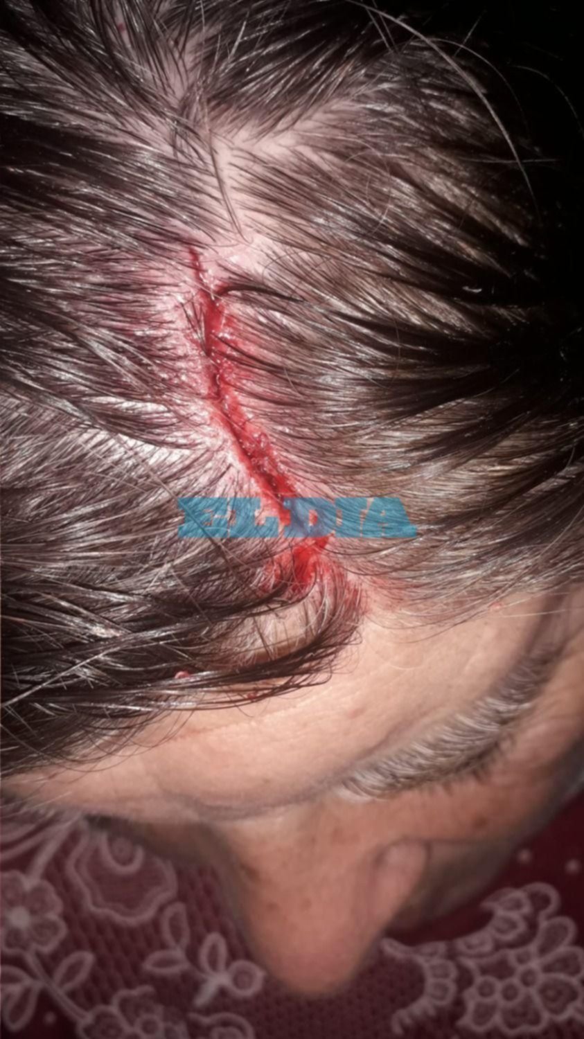 Delincuencia sin límites en La Plata: atacaron a culatazos a una mujer por resistirse a ser robada