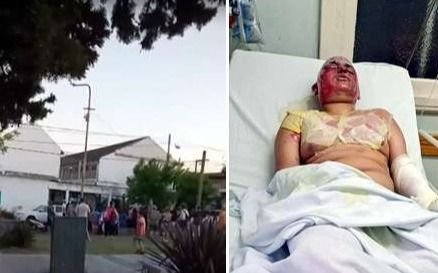Un alumno herido con graves quemaduras al participar de una feria de ciencias en Laferrere