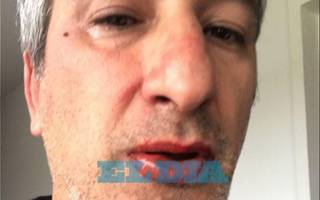 Fue a reclamar porque la grúa le llevó el auto en La Plata y le dieron una paliza