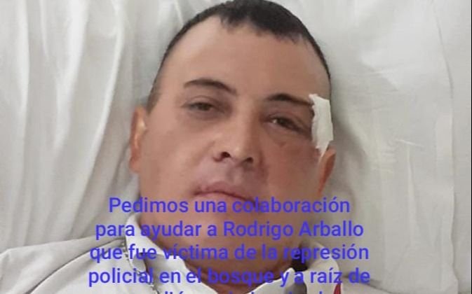 El hincha de Gimnasia que puede perder la vista pide ayuda para costear los gastos médicos
