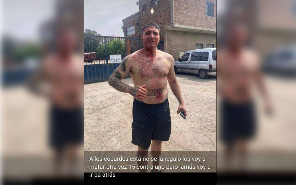 "Los voy a matar": ensangrentado, el nieto del Pata Medina prometió venganza