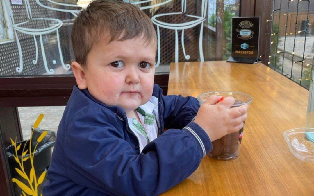 Quién es Hasbulla, el adulto que parece un niño y que dará un show en el Gran Rex: venta de entradas