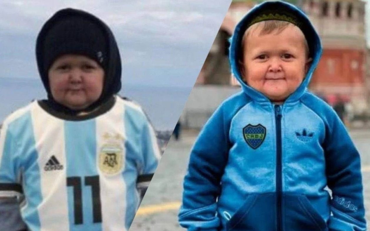 Quién Es Hasbulla El Adulto Que Parece Un Niño Y Que Dará Un Show En