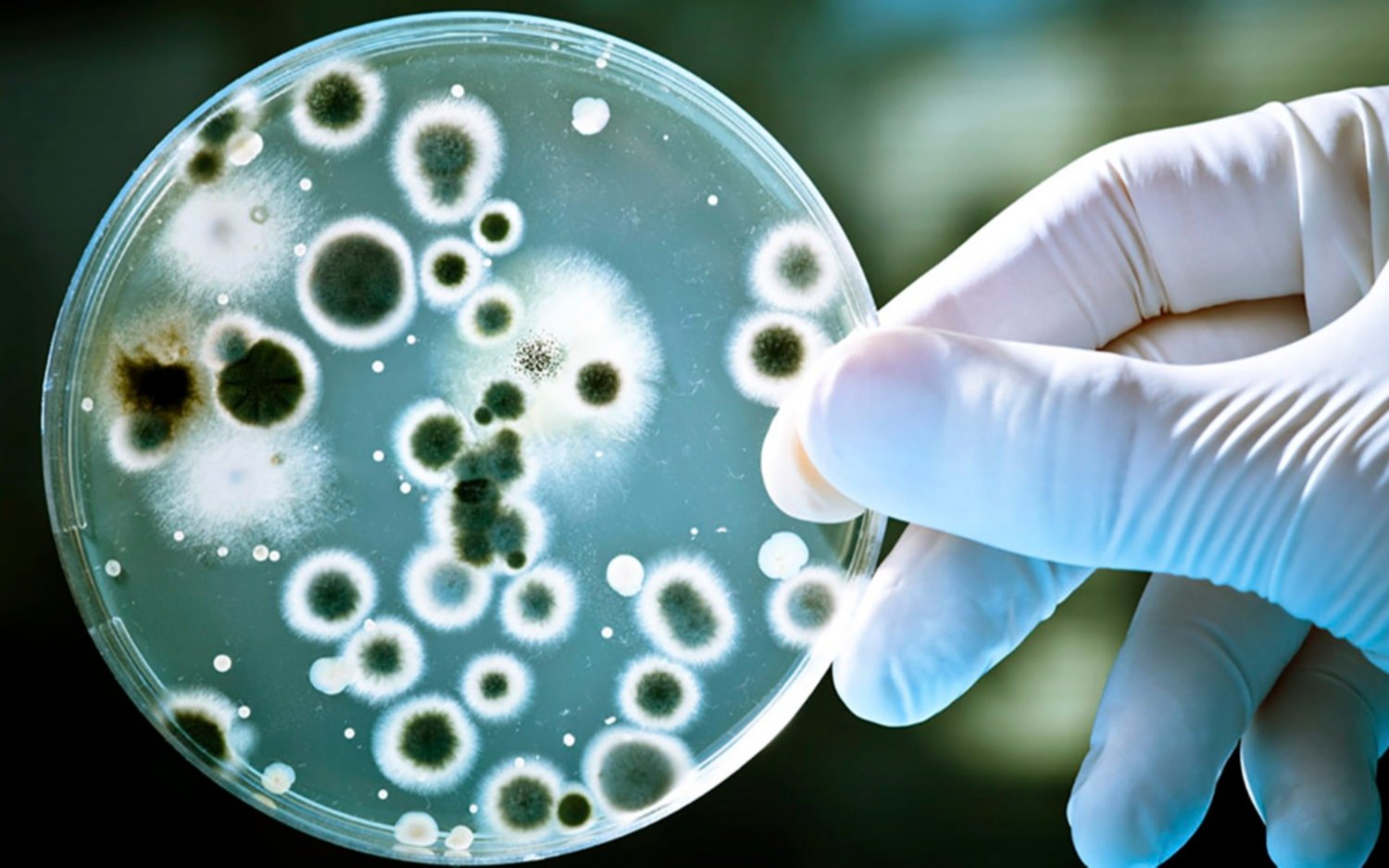 Confirman primeros casos del hongo Candida Auris en Argentina: ¿cómo se contagia?