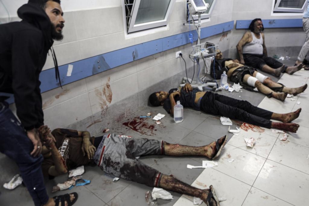 En el piso y sin anestesia: así operan en hospitales de Gaza