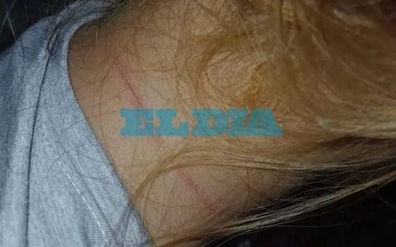 "Me ahorcaron, golpearon y patearon", la brutal agresión que denunció una joven en La Plata
