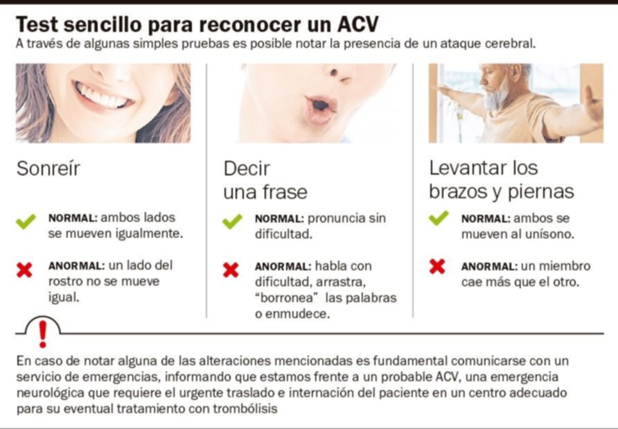 Accidente cerebrovascular: un 70% de la gente no sabe qué hacer